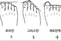 사람마다 다른 발가락 모양.jpg