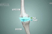 양반다리 쭈그려앉기 나쁜점